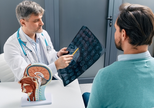 A doctor showing a brain scan to a male patient in a clinical setting, with a model of the human brain on the desk.